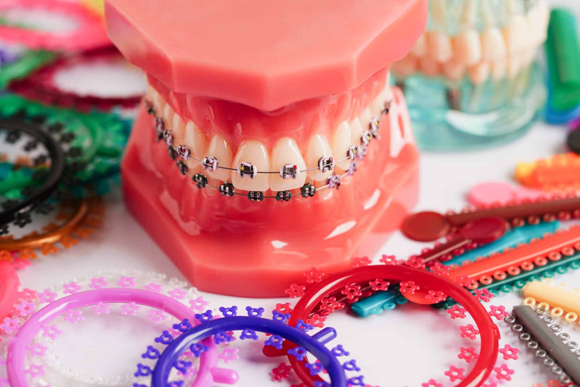 Orthodontic ligatures rings and ties, elastic rubber bands on orthodontic braces, model for dentist studying about dentistry.